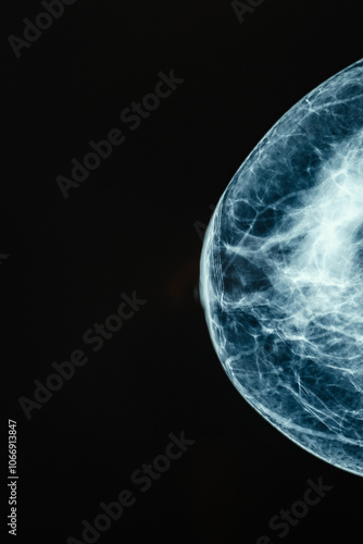 Obraz na płótnie Xray Image of Breast Tissue intended for professional Medical Review and analysis w salonie