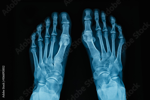 Obraz na płótnie XRay Image of Human Feet Showing Intricate Bone Structure with Exceptional Detail w salonie