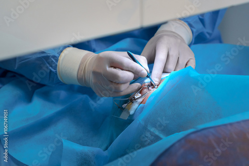 Close-Up of Surgeon Performing Eye Microsurgery photo