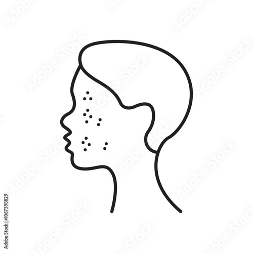 Acne icon simple black line style.