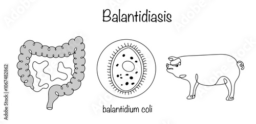 Balantidiasis photo