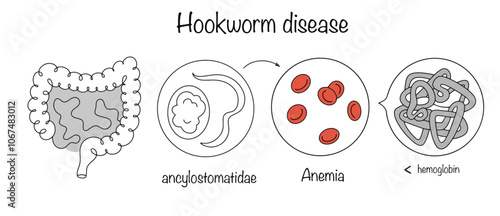 Hookworm disease