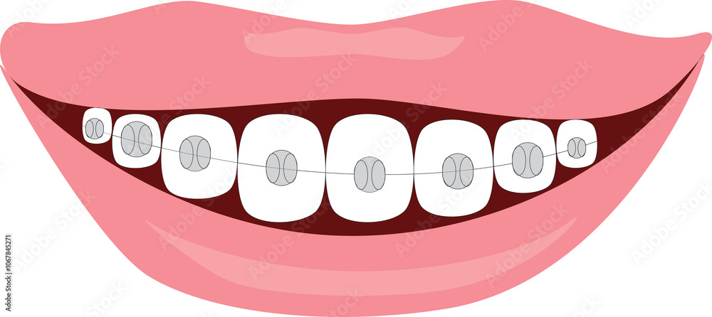 Obraz premium A vector art of mouth opened with a smile and wearing braces.