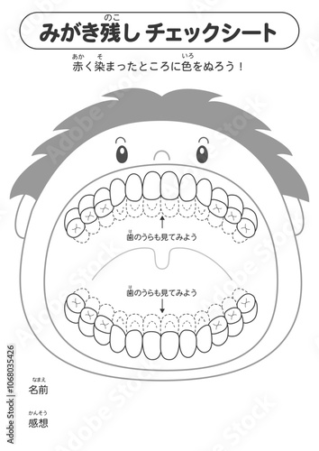混合歯列期の磨き残しチェックシート　染め出しイラスト