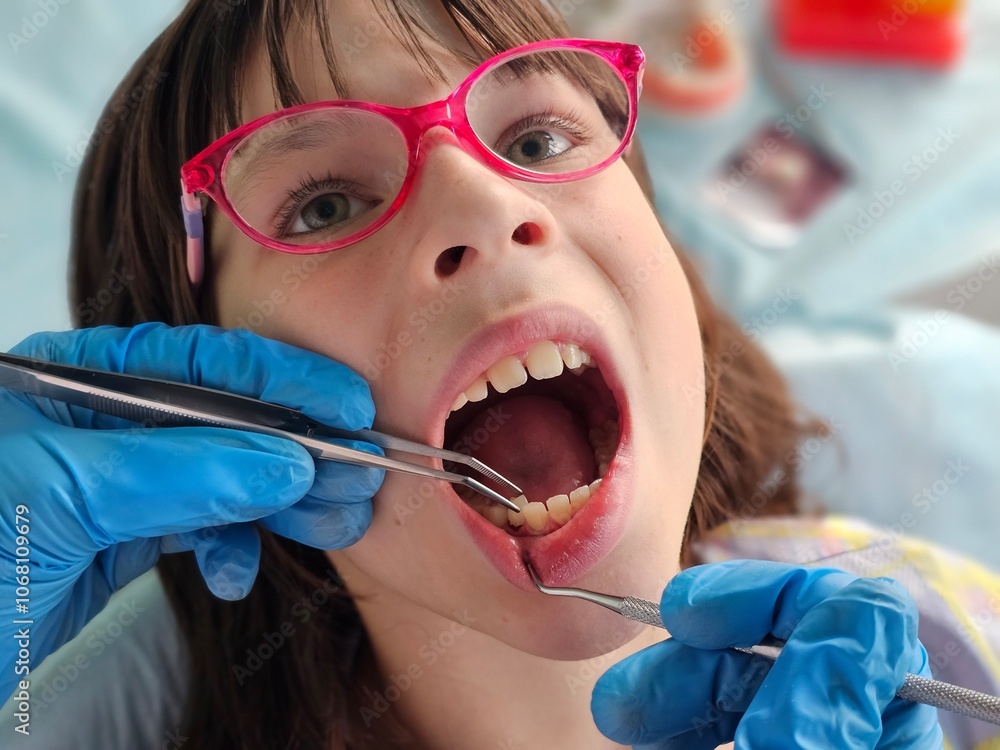 Fotografie Dentist holds extracted tooth with caries with forceps
