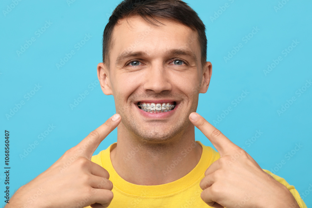 Smiling man pointing at his dental braces on light blue background Smiling man pointing at his dental braces on light blue background