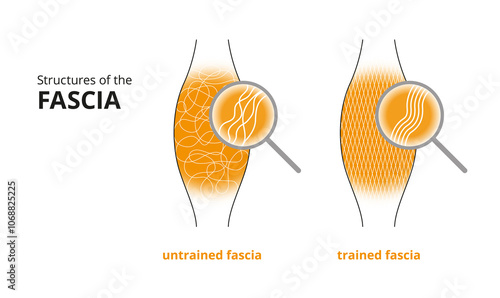 Illustration of a trained and untrained fascia