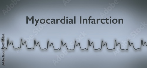Electrocardiography line show myocardial infarction