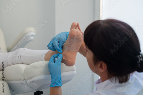 A podologist wearing gloves glues a special relief corn patch on the heel of the patient. Patient on medical pedicure procedure, visiting podiatrist. Peeling feet. Foot treatment in SPA salon.Podiatry