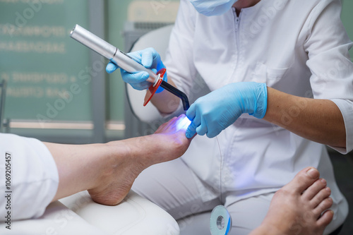 Рodologist in gloves puts a titanium thread on a toenail with special polymerization ultraviolet lamp. Patient on medical pedicure procedure, visiting podiatrist. Peeling feet. Foot treatment in SPA s