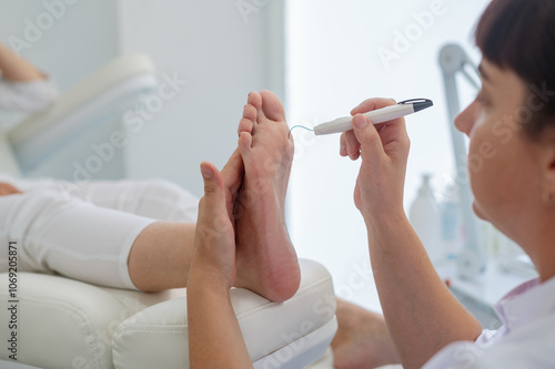 A podologist checks the diabetic  foot  with a Diabetic Foot Probe. Patient on medical pedicure procedure, visiting podiatrist. Peeling feet. Foot treatment in SPA salon.Podiatry photo