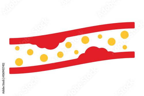 High blood cholesterol colorful icon with a arteriosclerosis risk. Clogged artery. Concept of high cholesterol and unhealthy lifestyle, fast food. thrombosis microvascular disease. Vector illustration