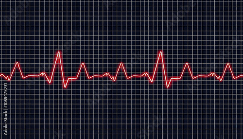 Electrocardiogram (ECG), heart wave, heart attack, cardiogram report highlighted by white, png photo