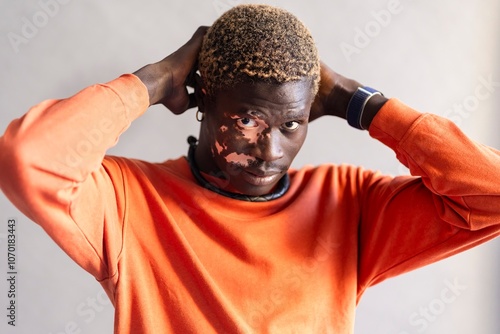 A man with vitiligo, dressed in an orange sweatshirt, is seen adjusting his hair with a thoughtful expression photo