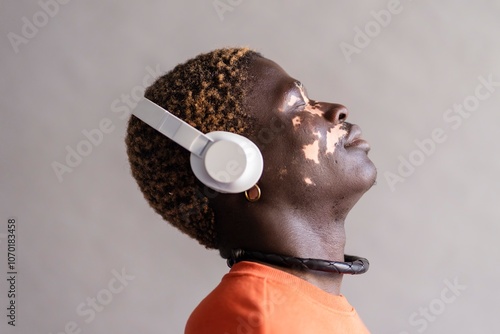 Side profile of a man with vitiligo wearing headphones and an orange sweatshirt, with his head tilted back and eyes closed