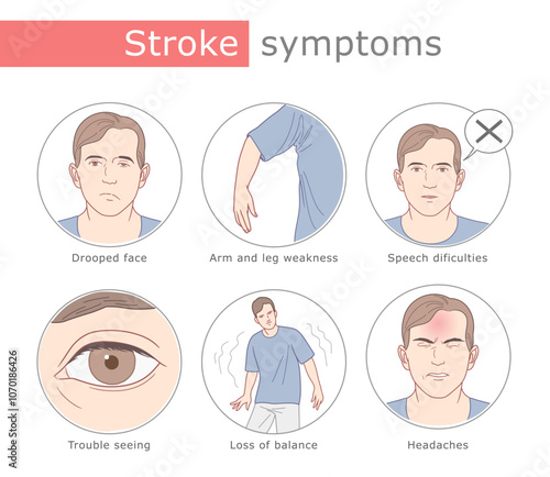 Stroke symptoms medical illustration. The illustration shows six main visual symptoms of stroke.