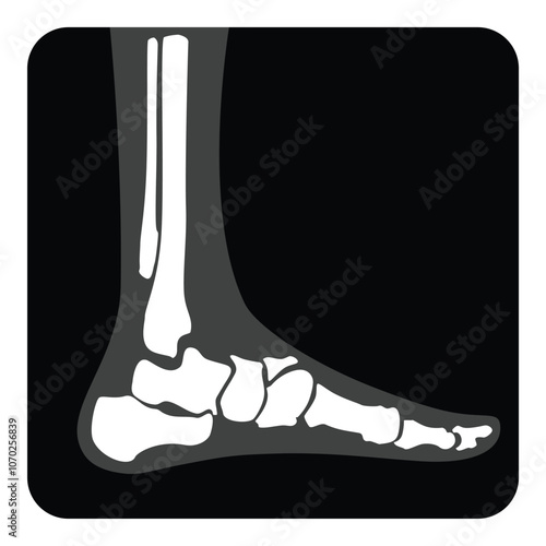X-ray ankle joint foot