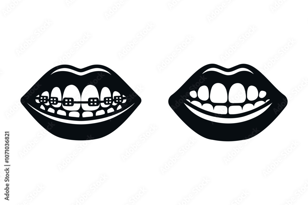 Teeth braces icon. smile with and without braces, Dental bracket system vector illustration. Tooth dentistry, isolated concept. Teeth braces icon. smile with and without braces, Dental bracket system vector illustration. Tooth dentistry, isolated concept.