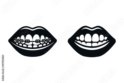 Teeth braces icon. smile with and without braces, Dental bracket system vector illustration. Tooth dentistry, isolated concept.