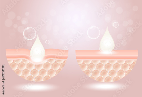 Before and after process of getting skin younger with help of moisturizer hyaluronic acid.