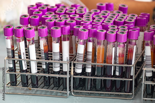 Close up of group of blood sample tubes of a blood donor, sample tubes for collecting patient's blood for laboratory diagnosis, medical equipment, Save life and medical treatment concept. photo