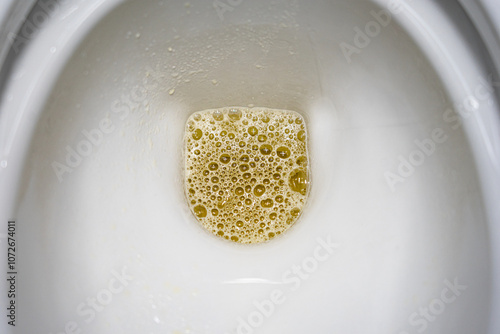 Принти на полотні white porcelain toilet bowl with yellow, foamy urine in the bottom