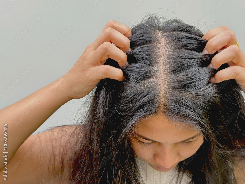 Obraz premium Women with hair loss dryness and frizziness