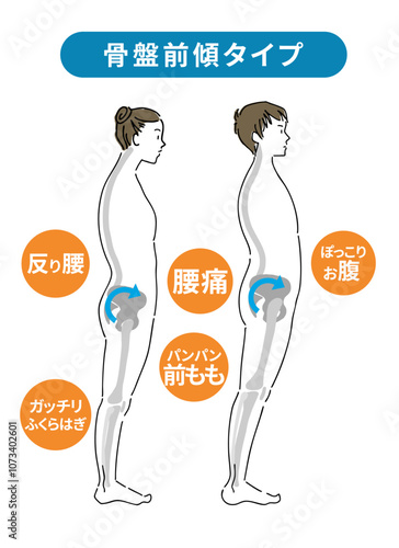 骨盤が前傾したときに体にもたらす影響と横向きの骨格イラスト