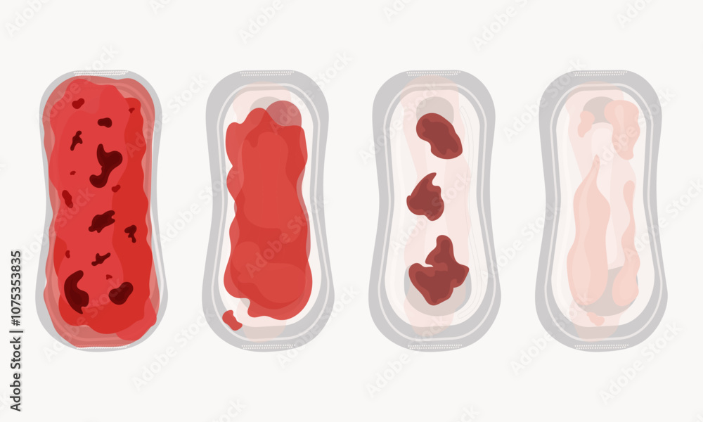 Vaginal postpartum bleeding - lochia. Lochia intensity scale on a set of sanitary pads. Isolates on a white background. Feminine hygiene. Women's health. Flat. Vector illustration. Vaginal postpartum bleeding - lochia. Lochia intensity scale on a set of sanitary pads. Isolates on a white background. Feminine hygiene. Women's health. Flat. Vector illustration.