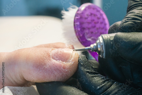 Professional hardware pedicurist, podiatrist cleaning nails using a nail miller photo