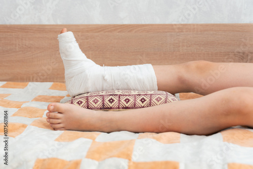 Children's legs, one leg is broken and in a cast photo