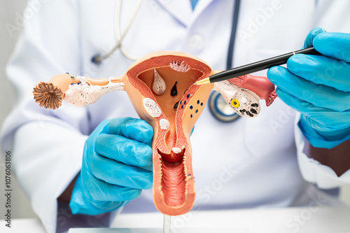 Uterus, doctor holding human anatomy model for study diagnosis and treatment in hospital. photo