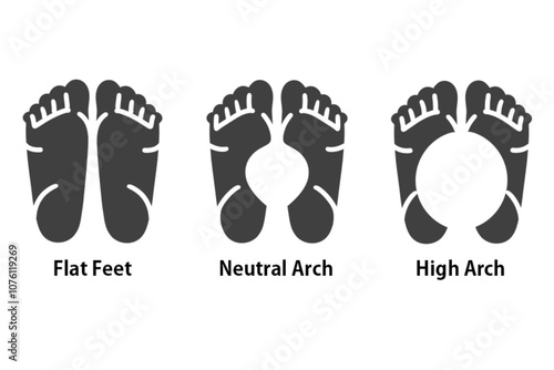 Foot Shape Vector Image: Flat Feet, Normal Arch, High Arch