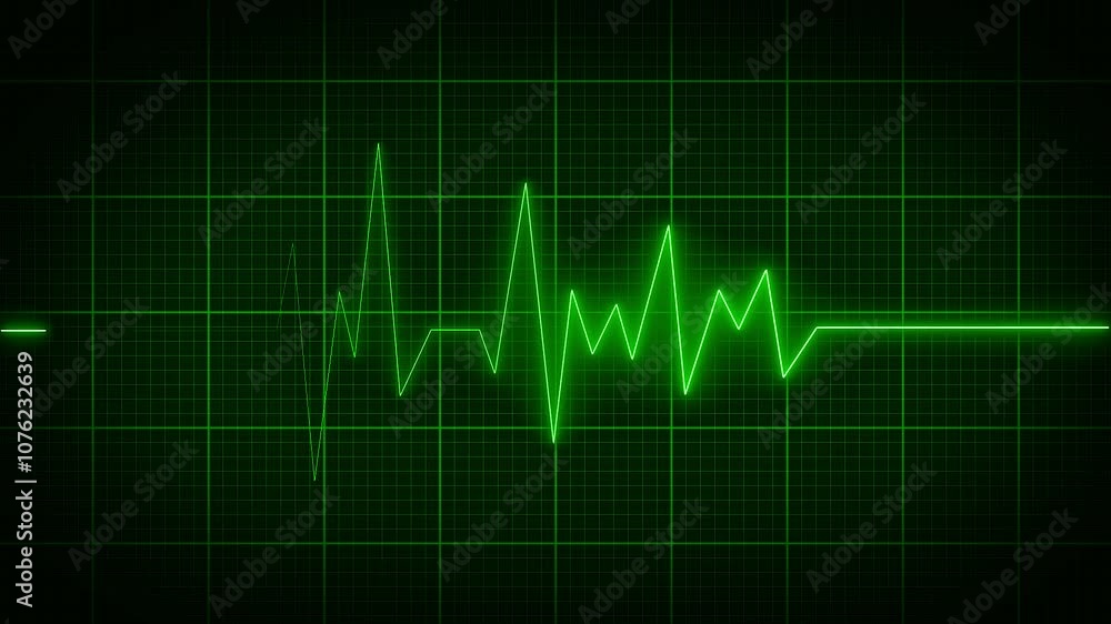Cardiogram heartbeat pulse rate neon glowing video animation. Emergency ekg monitoring. loop motion animate 4k video footage. Abstract heartbeat. Cardiogram heartbeat pulse rate neon glowing video animation. Emergency ekg monitoring. loop motion animate 4k video footage. Abstract heartbeat.