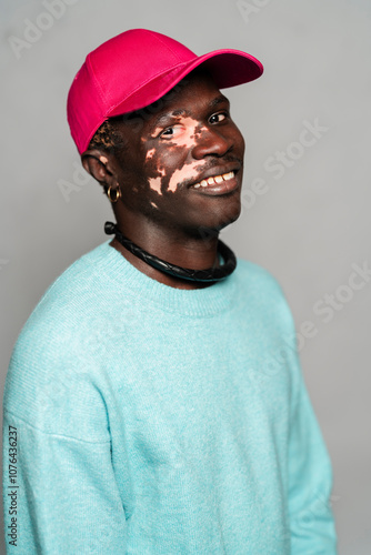 Portrait of a young man with vitiligo wearing a turquoise sweater and pink cap, smiling warmly with a joyful expression, showing confidence and individuality against a soft gray background. photo