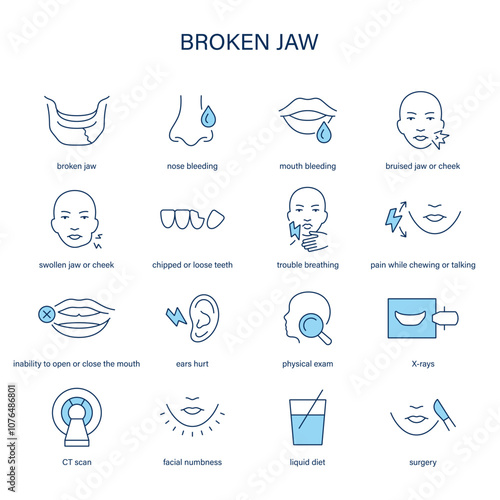 Broken Jaw symptoms, diagnostic and treatment vector icon set. Medical icons.