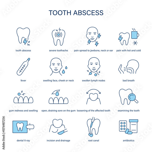 Tooth Abscess symptoms, diagnostic and treatment vector icon set. Medical icons.