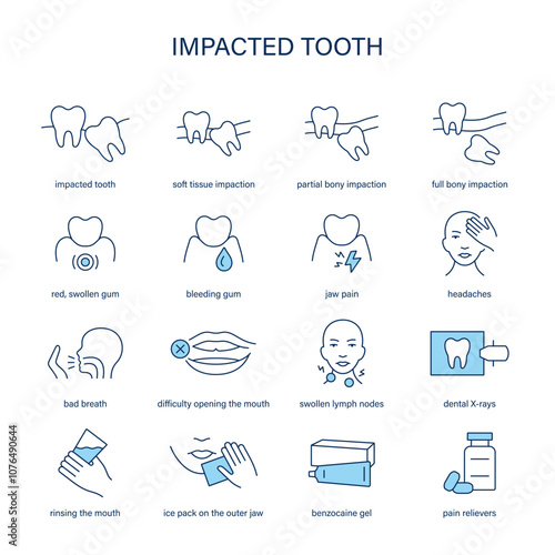 Impacted Tooth symptoms, diagnostic and treatment vector icon set. Medical icons.