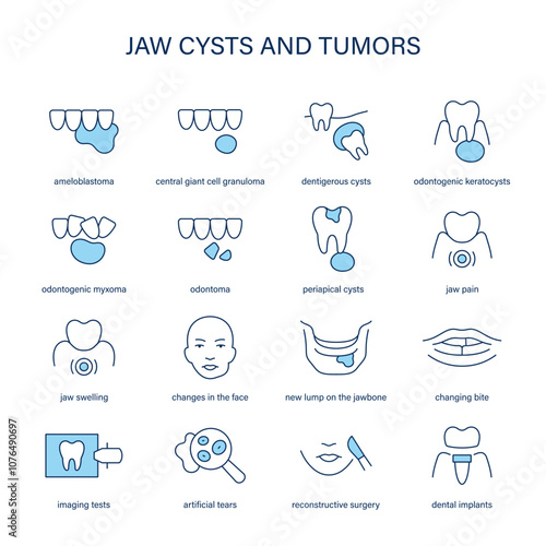 Jaw Cysts and Tumors symptoms, diagnostic and treatment vector icon set. Medical icons.
