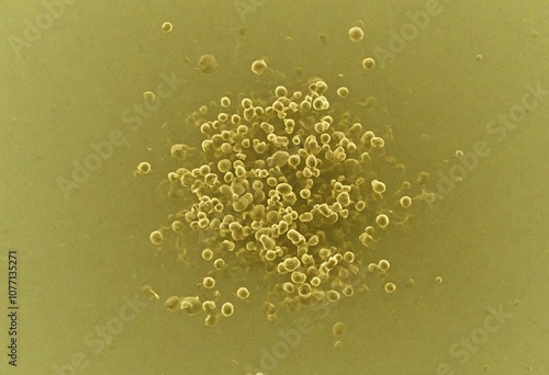 Staphylococcus aureus colonies in a petri dish with mannitol salt agar medium. Generative AI. photo