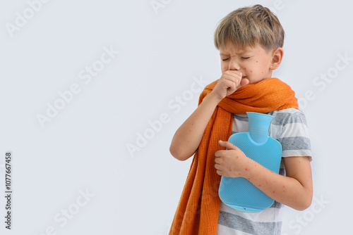 Little boy ill with chickenpox and hot water bottle coughing on white background photo