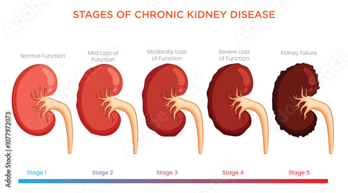 Stages of Chronic Kidney Disease Progression from Mild Impairment to Severe Renal Failure