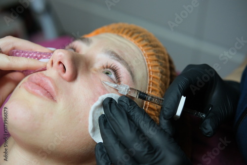 A cosmetologist makes multiple biorevitalization injections to a woman's face