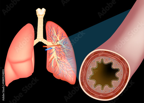 Medical Illustration Anatomy Bronchus. Branchial wall cros-section. Respiratory system. Mucociliary escalator, cilia and goblet cells. 