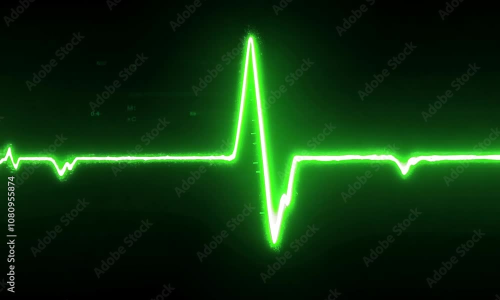 Green EKG Line on Black Background Green EKG Line on Black Background