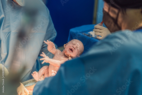Valokuva A baby is delivered during a caesarean section