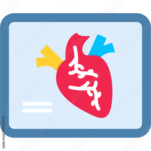 Ventriculography Icon