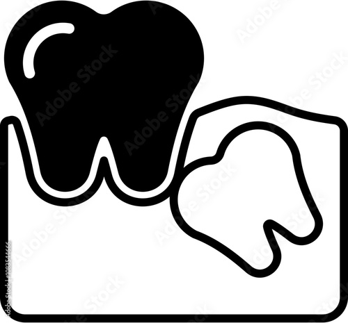 Wisdom Tooth