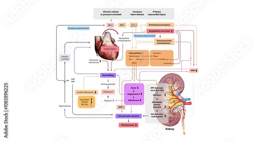 pathophysiology of heart failure, detailing mechanisms like volume overload, neurohormonal activation, remodeling, and organ perfusion changes