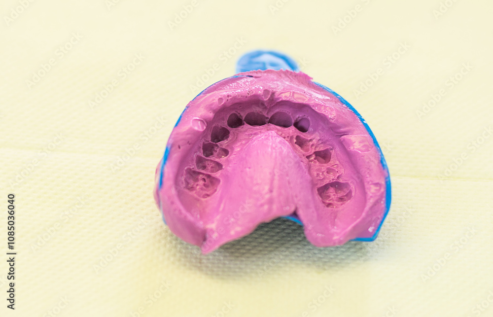The meticulous dental mold lays on a flat surface, revealing the detailed contours of teeth and gums in bright pink, framed by a striking blue outer layer, reflecting careful design work. The meticulous dental mold lays on a flat surface, revealing the detailed contours of teeth and gums in bright pink, framed by a striking blue outer layer, reflecting careful design work.